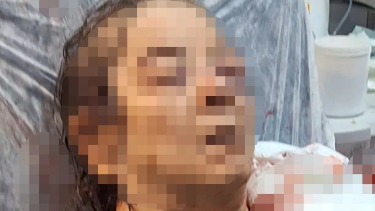 Il crollo di un soffitto ferisce una donna di 75 anni a Kayseri