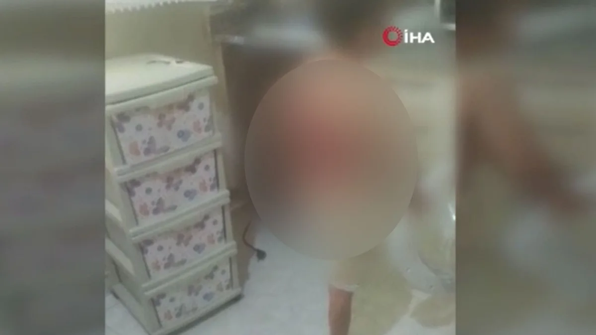 Un niño de 12 años sufre quemaduras de tercer grado en un incidente en Arnavutköy